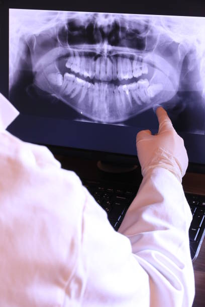 Best Emergency Gum Treatment in Center Point, TX