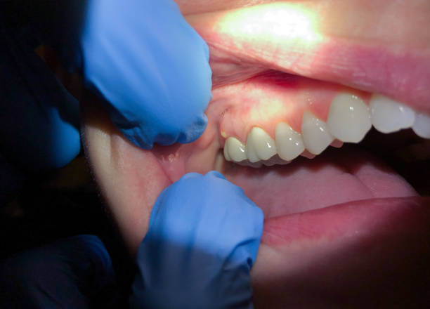 Best Emergency TMJ Treatment in Center Point, TX